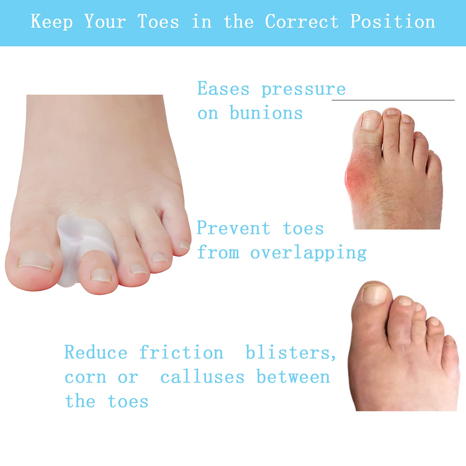 Pack of 12 toe spreaders for overlapping toes