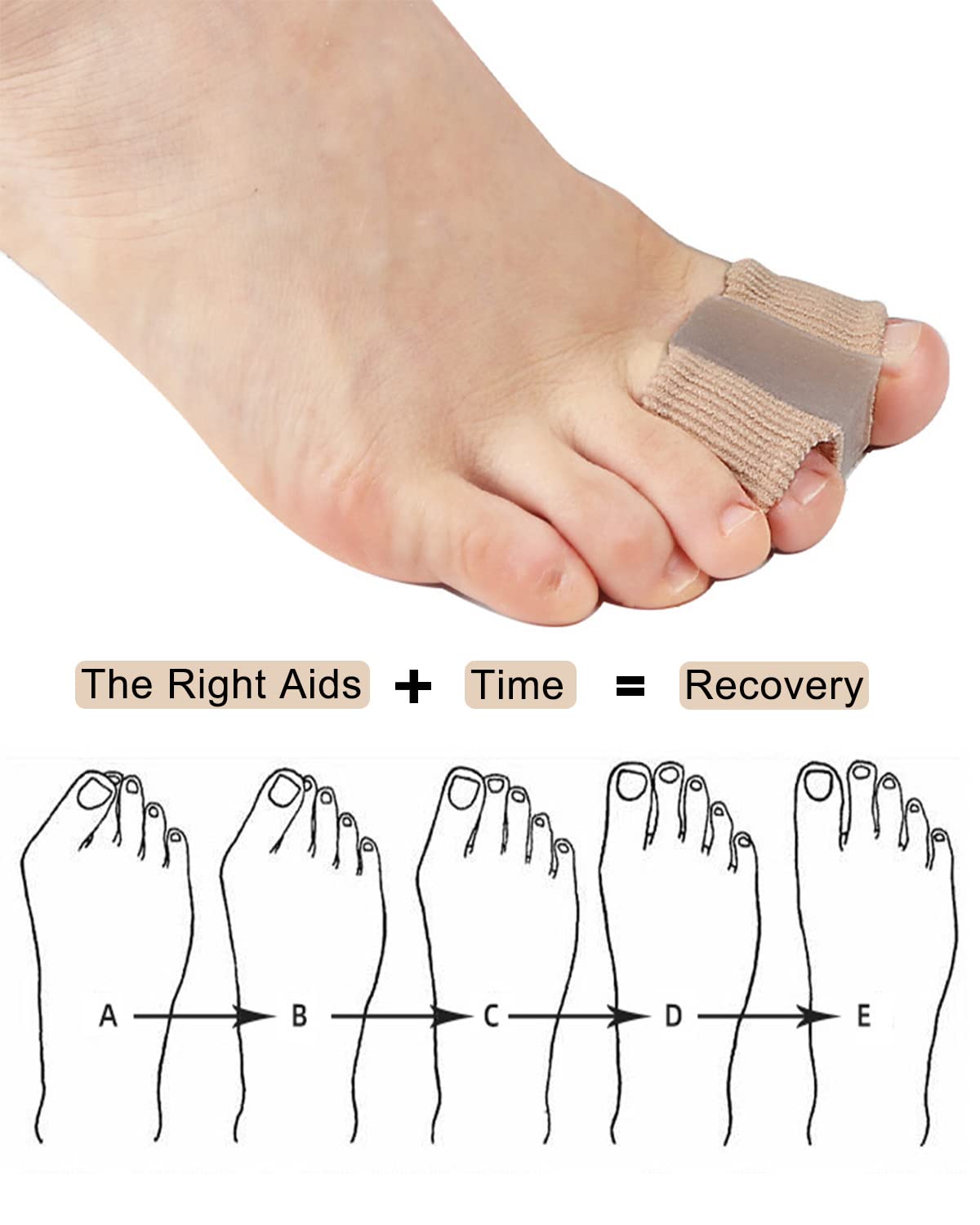 Golbylicc gel toe spacers showing two-loop design for stability