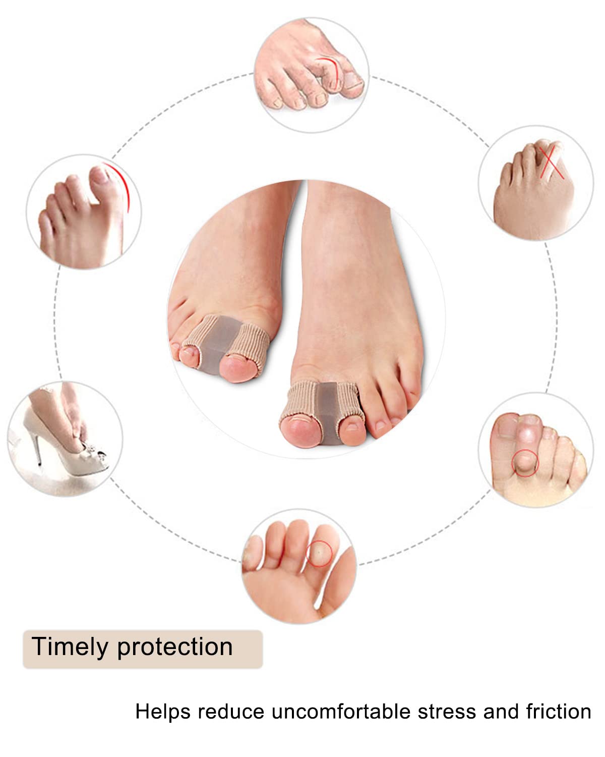 Top view of bunion toe separators on feet for alignment