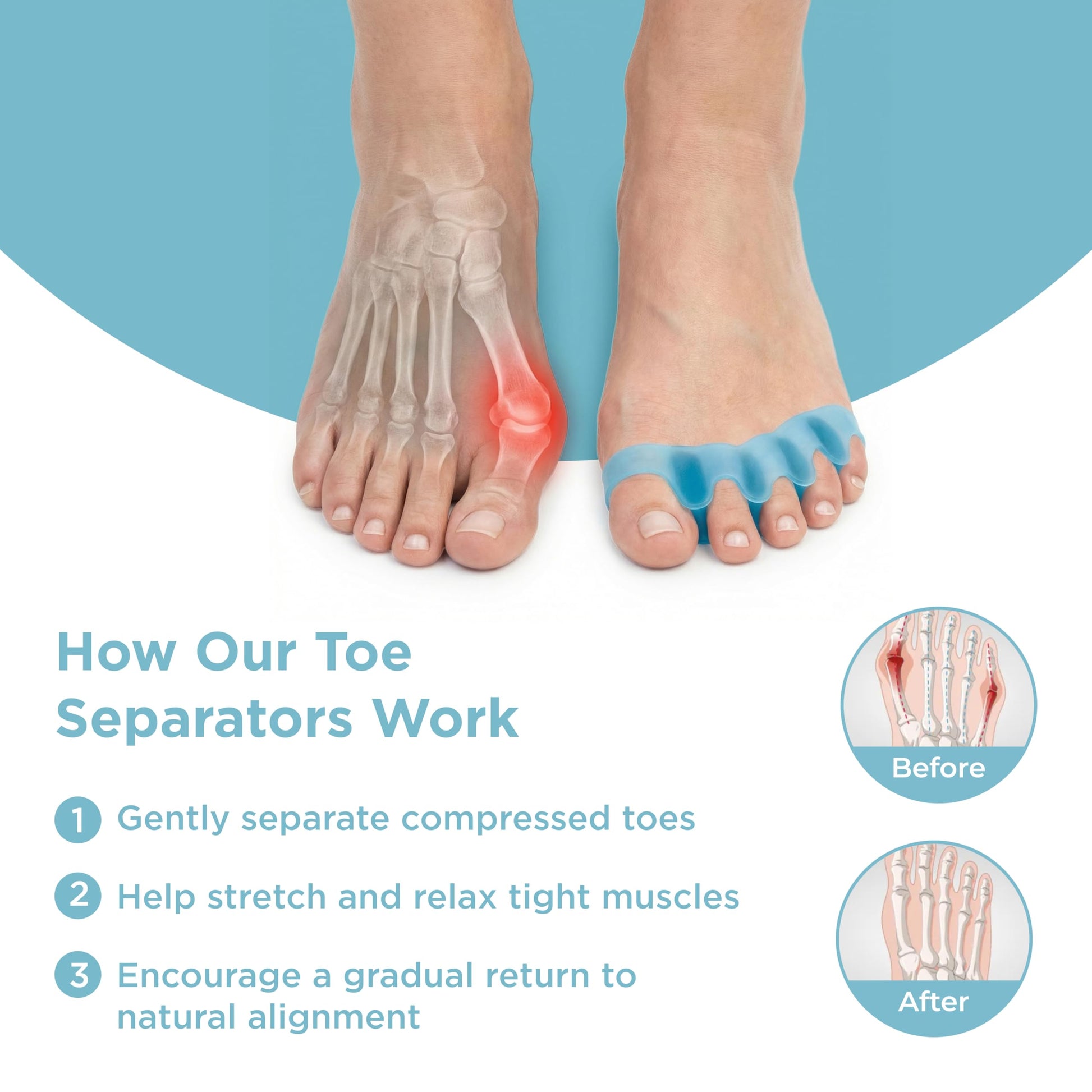 Side profile of Mind Bodhi regular size blue toe separators