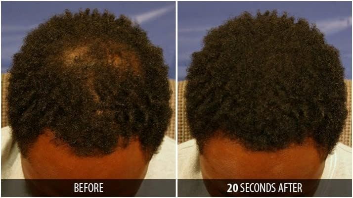 Dr. Yates MD Keratin Fiber Hair Enhancer Dark Blonde texturized protein powder view for thinning hair.
