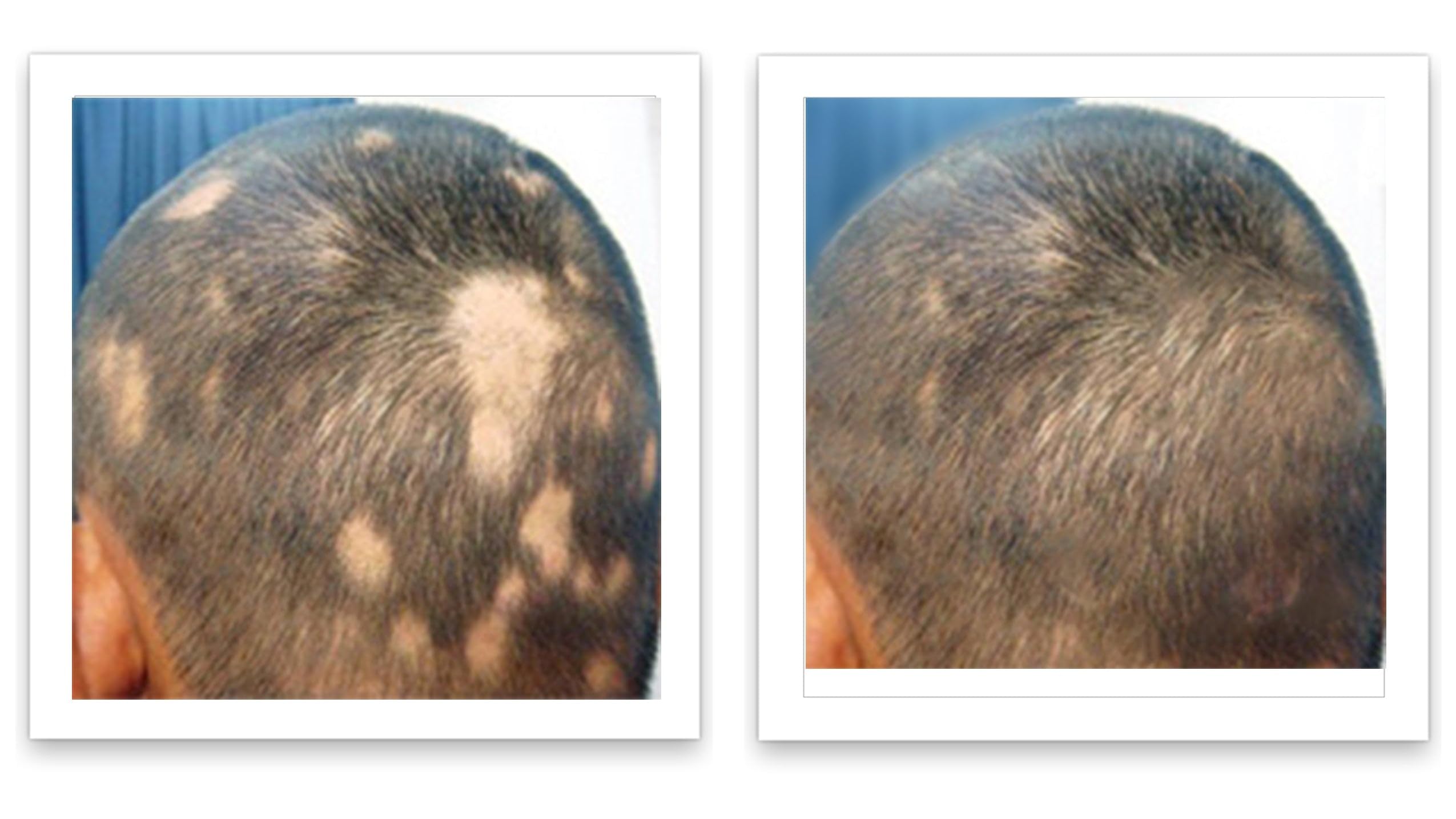 Caboki talc-free hair fiber powder container base and lid details
