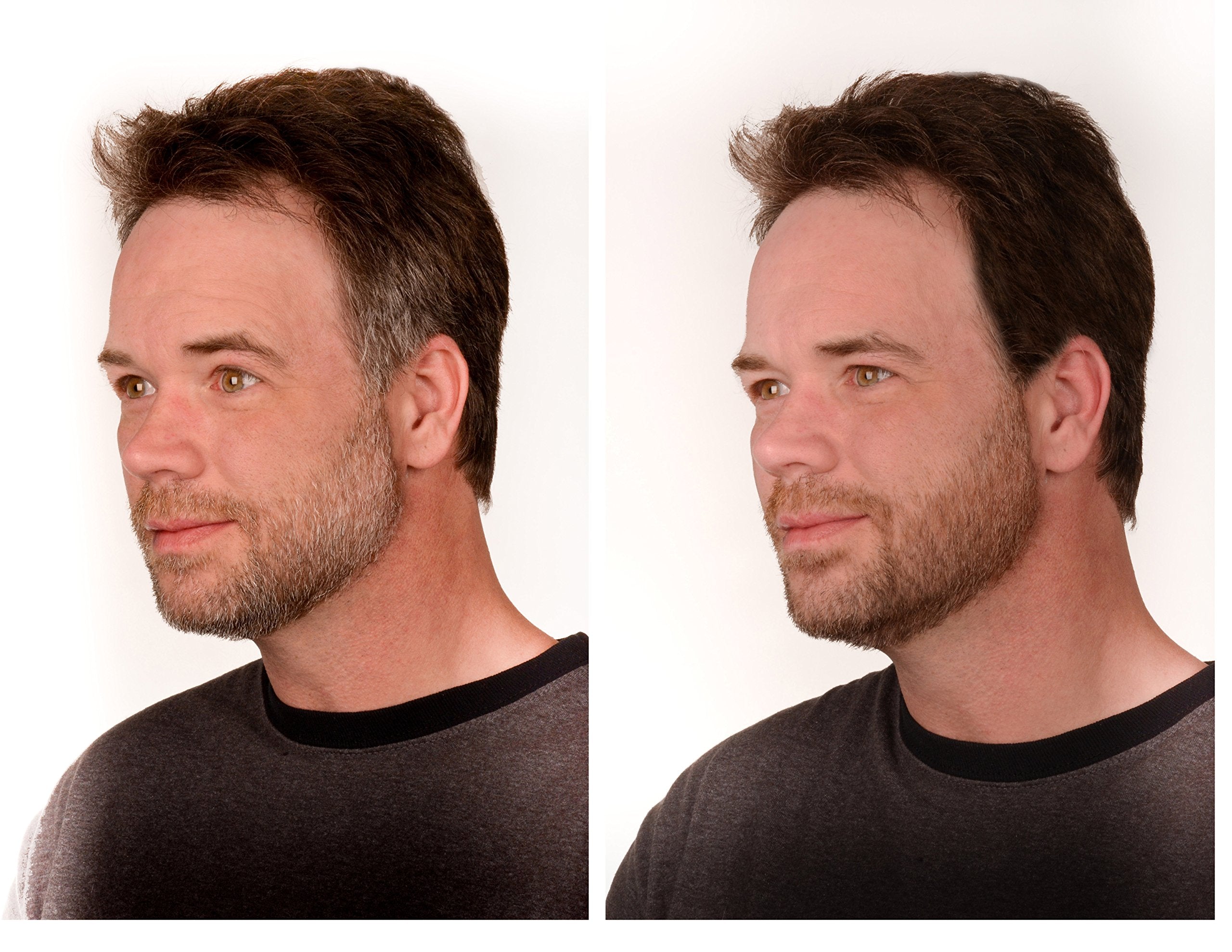 Before and after results using dark blonde facial hair color corrector