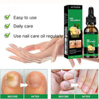 Applying Aguppo ginger cuticle oil to fingernails
