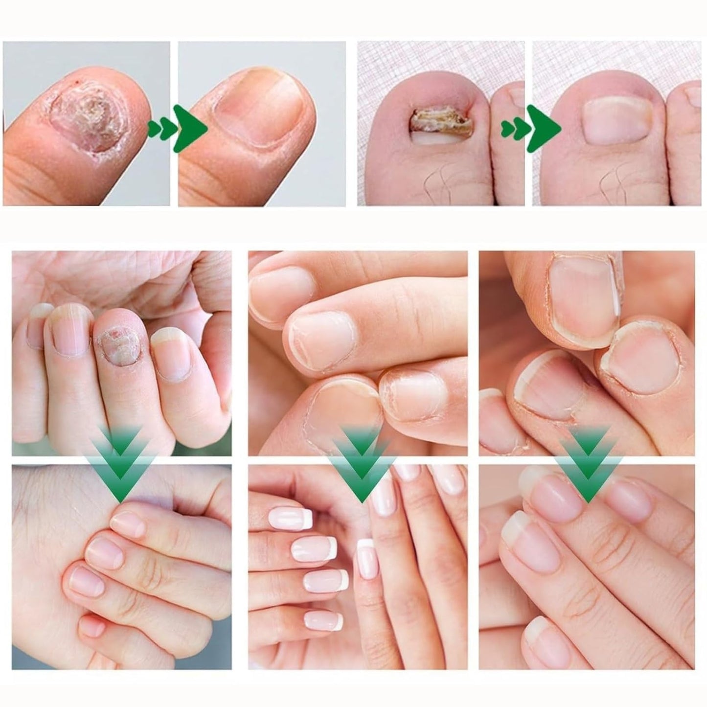 Instructions for using Aguppo ginger nail care serum