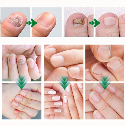 Instructions for using Aguppo ginger nail care serum