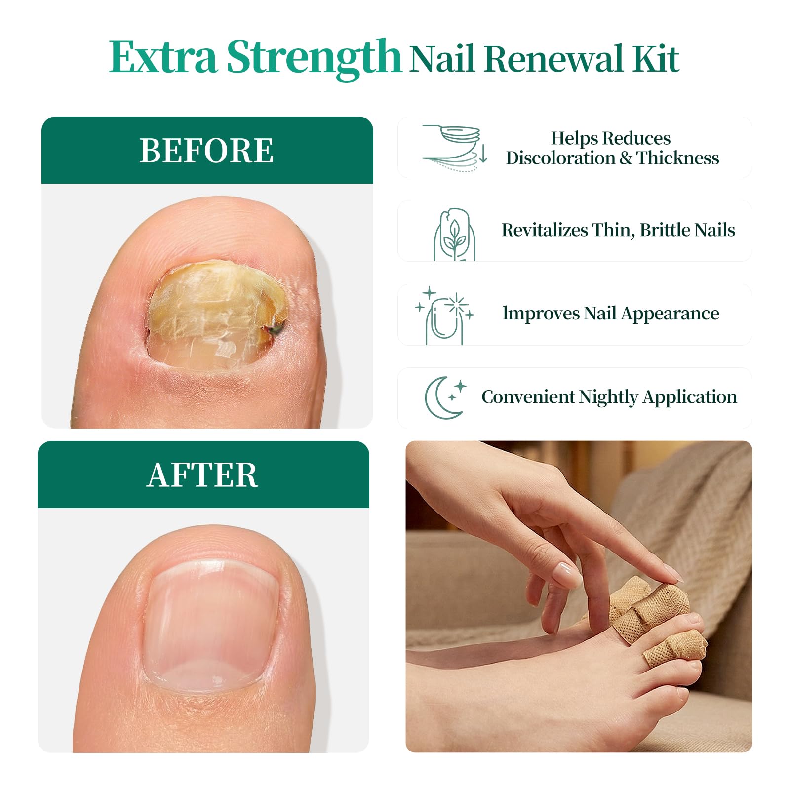 APUREE extra strength overnight toenail repair patch being applied directly onto a discolored nail surface.