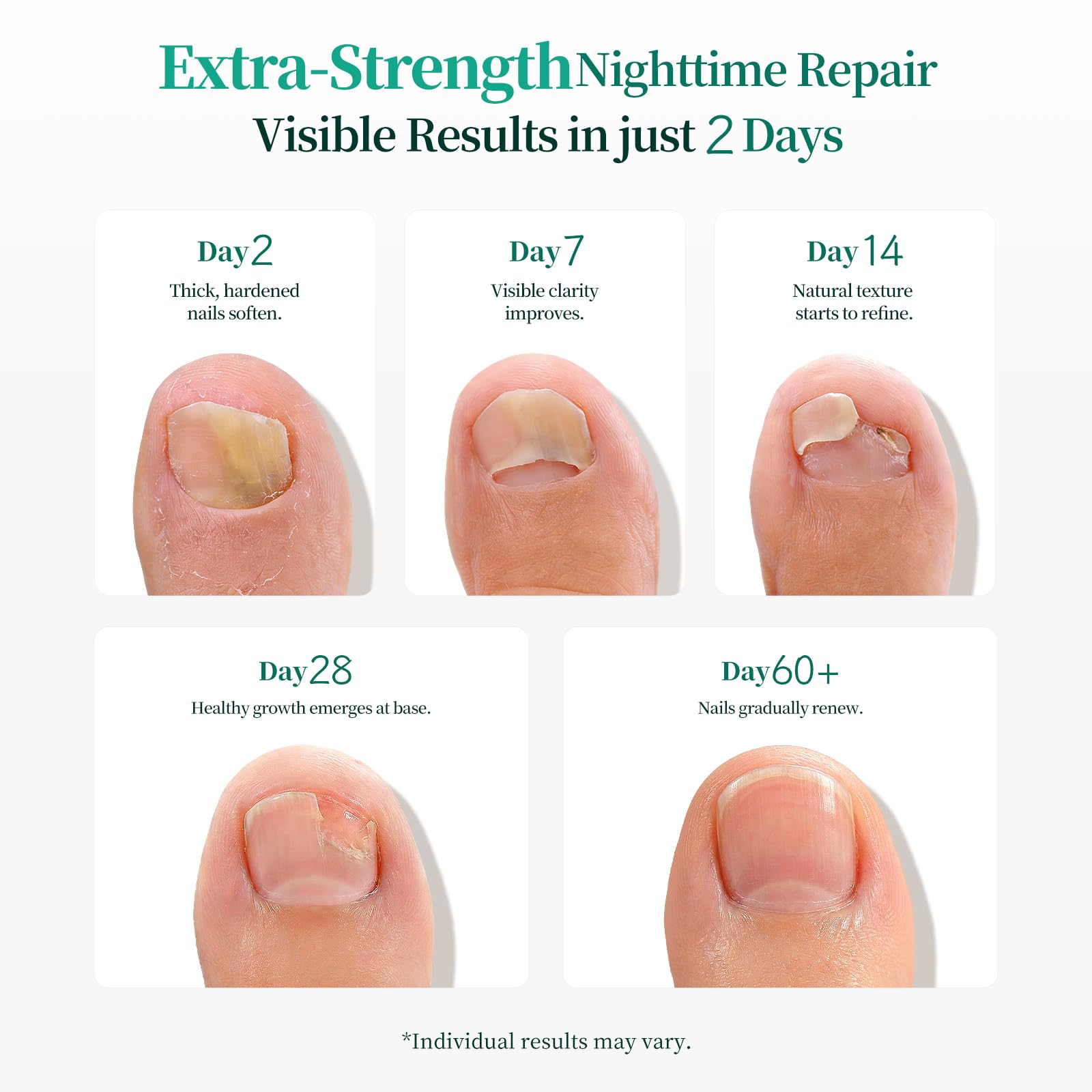 Close up view of the waterproof and breathable APUREE overnight patch applied firmly on a toe.