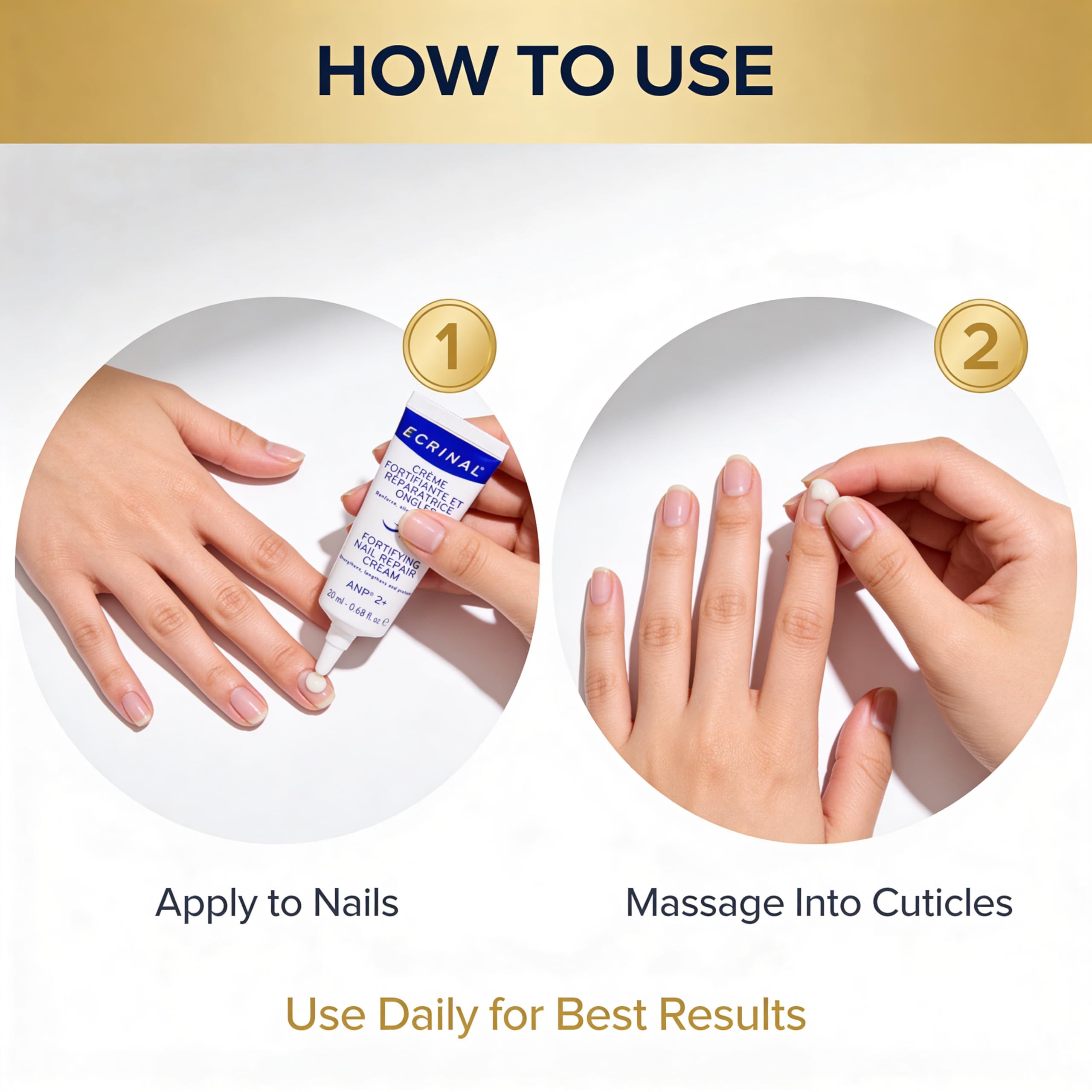 Application of Ecrinal nail cream on cuticles