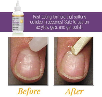 ProLinc instant cuticle remover for manicures