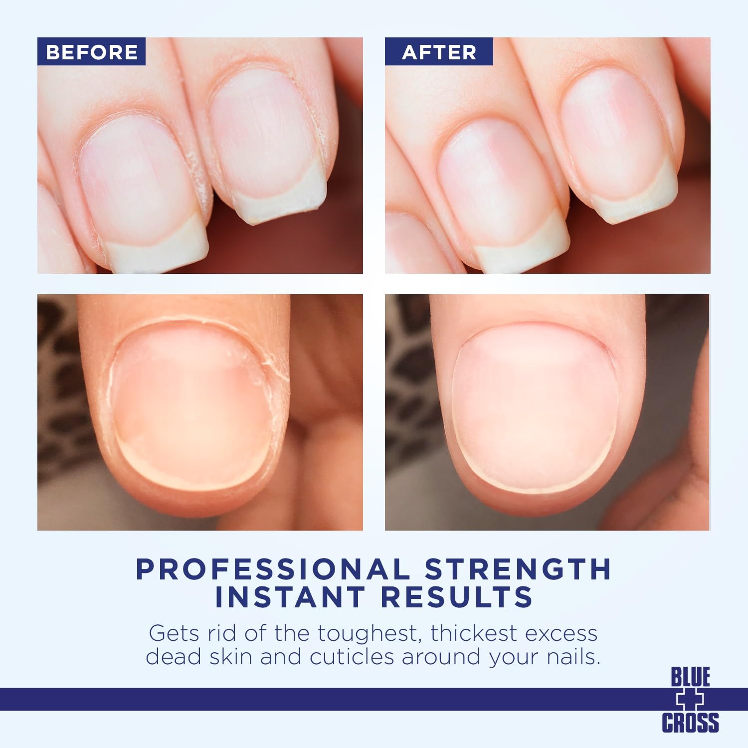 Blue Cross liquid cuticle remover with lanolin bottle label