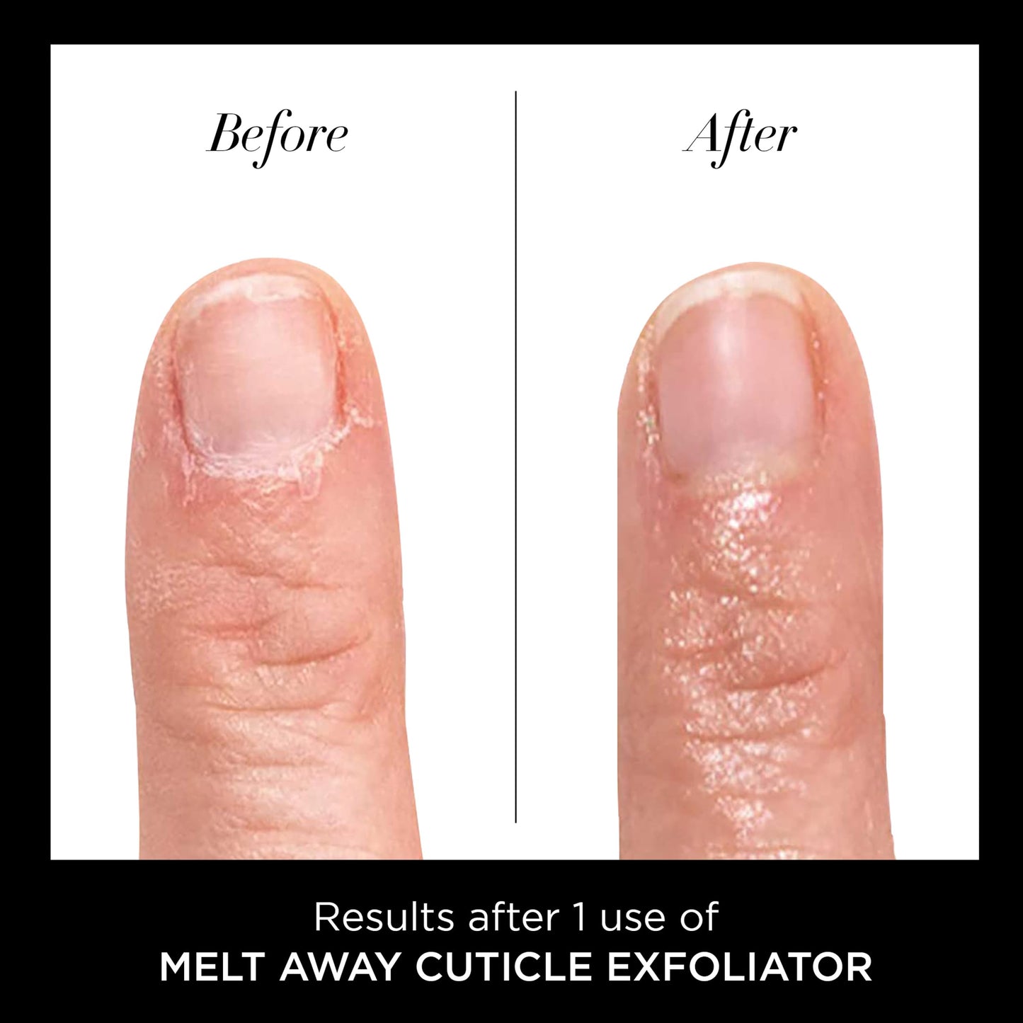 Butter London Melt Away nail treatment packaging
