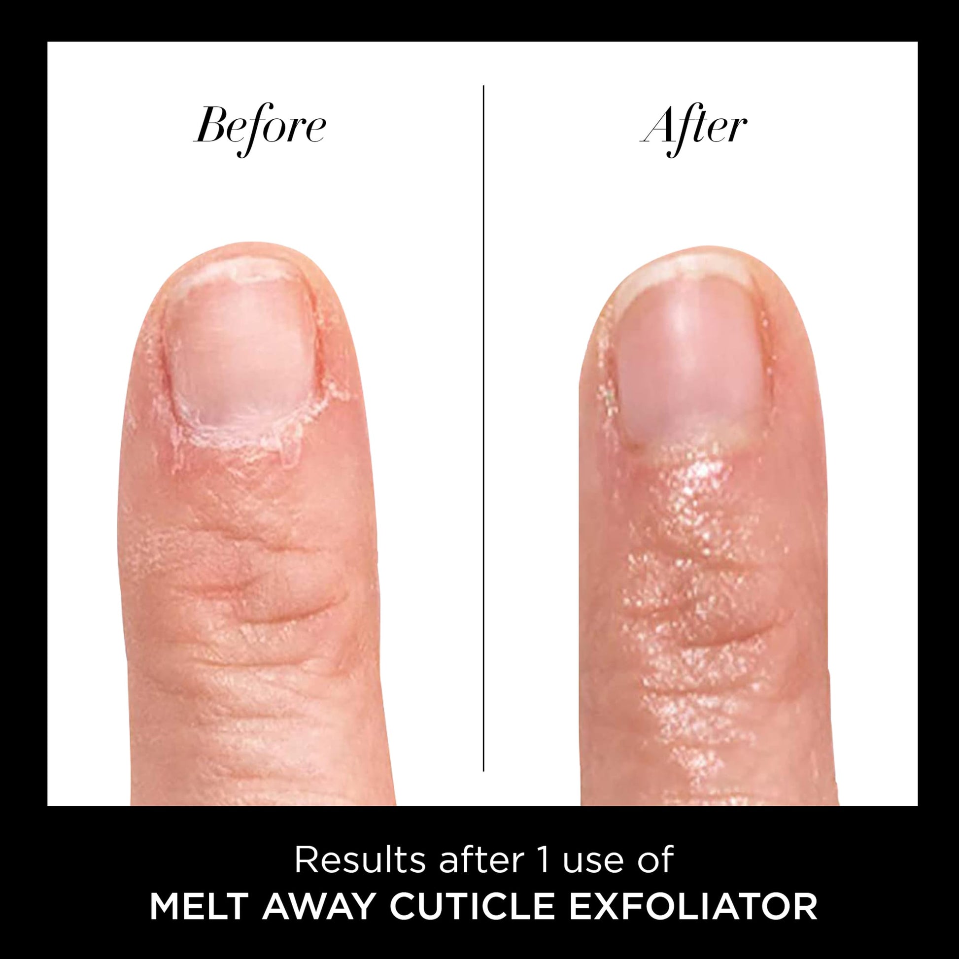 Butter London Melt Away nail treatment packaging