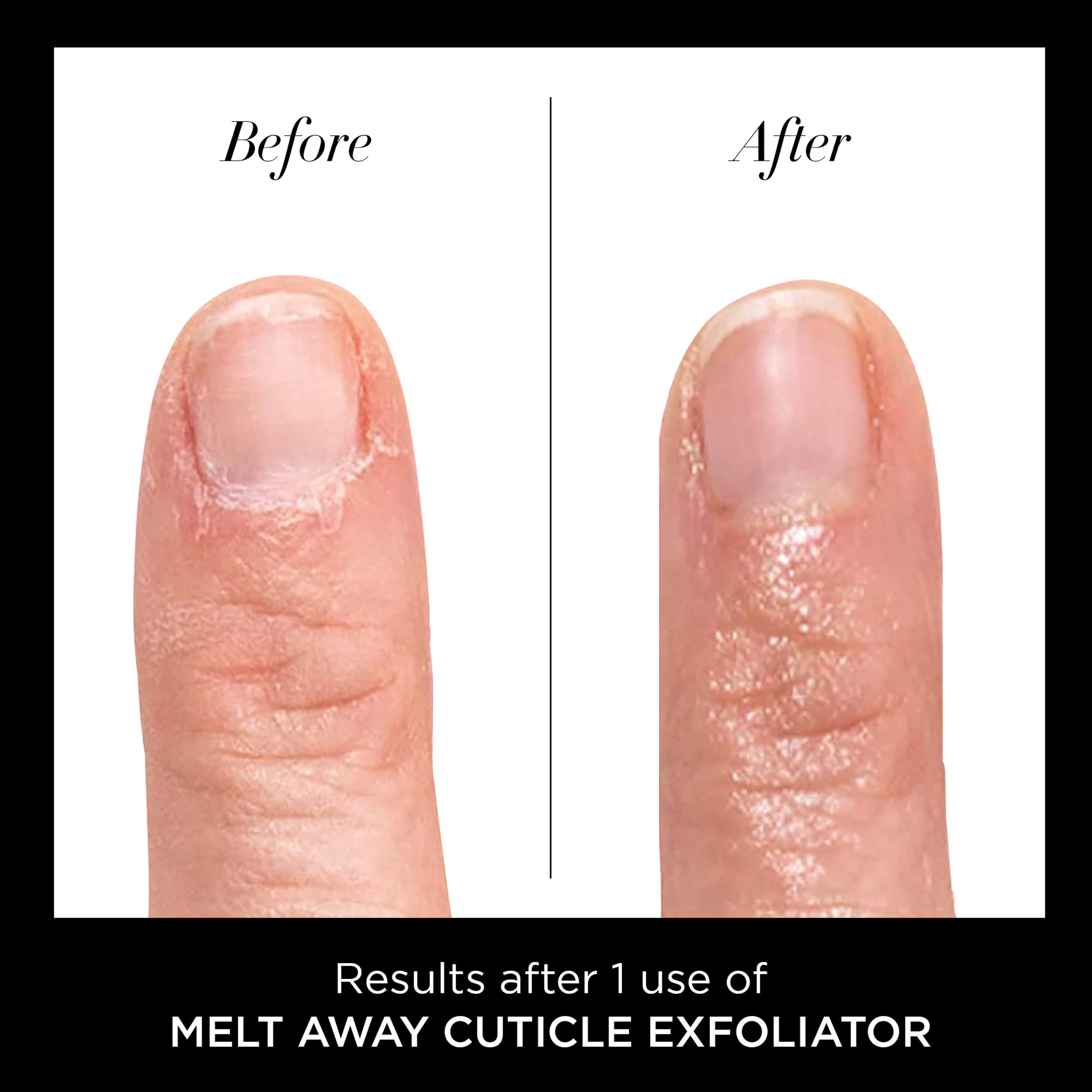 Butter London Melt Away nail treatment packaging