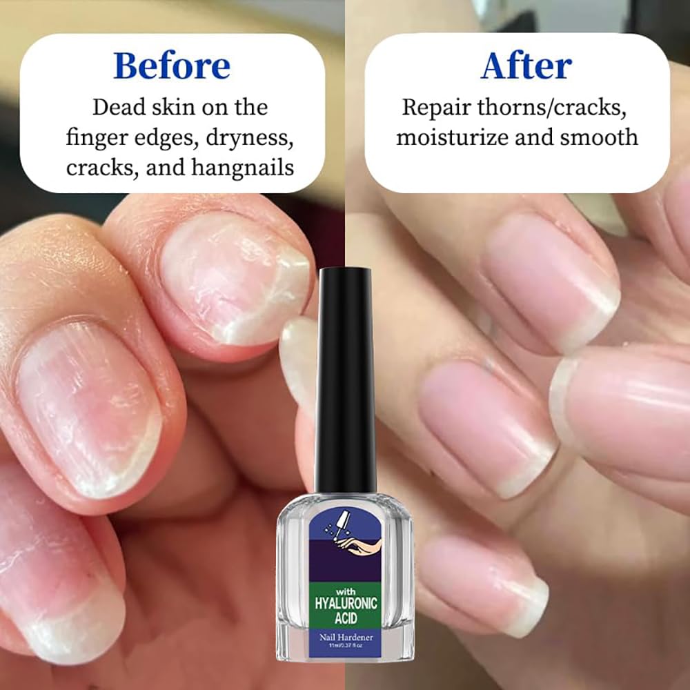 Two bottles of Tanakeji Oprtuisi repair serum for nails