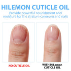 Vitamin E infused cuticle oil bottle displayed on a clean surface