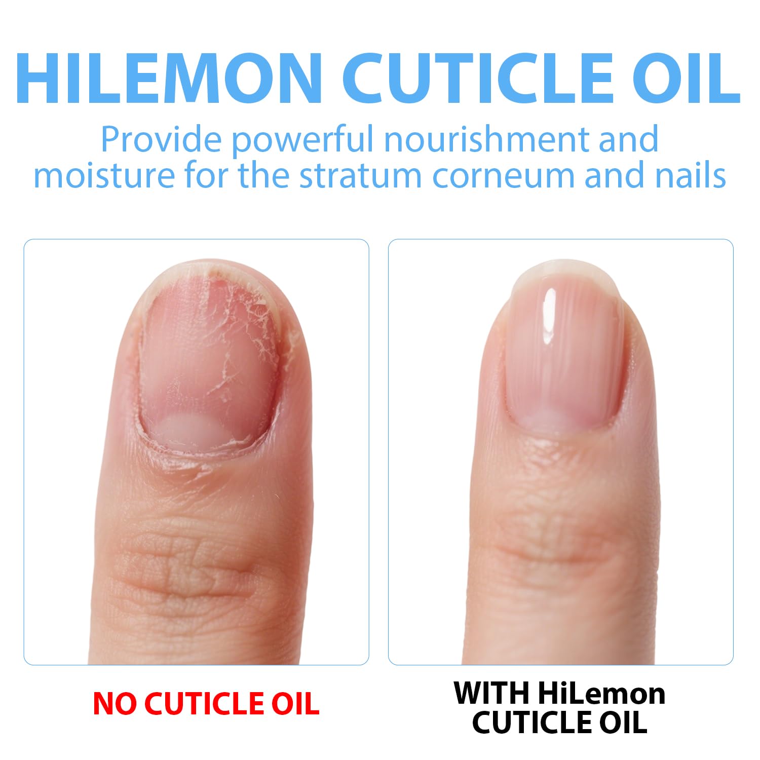 Vitamin E infused cuticle oil for dry nails