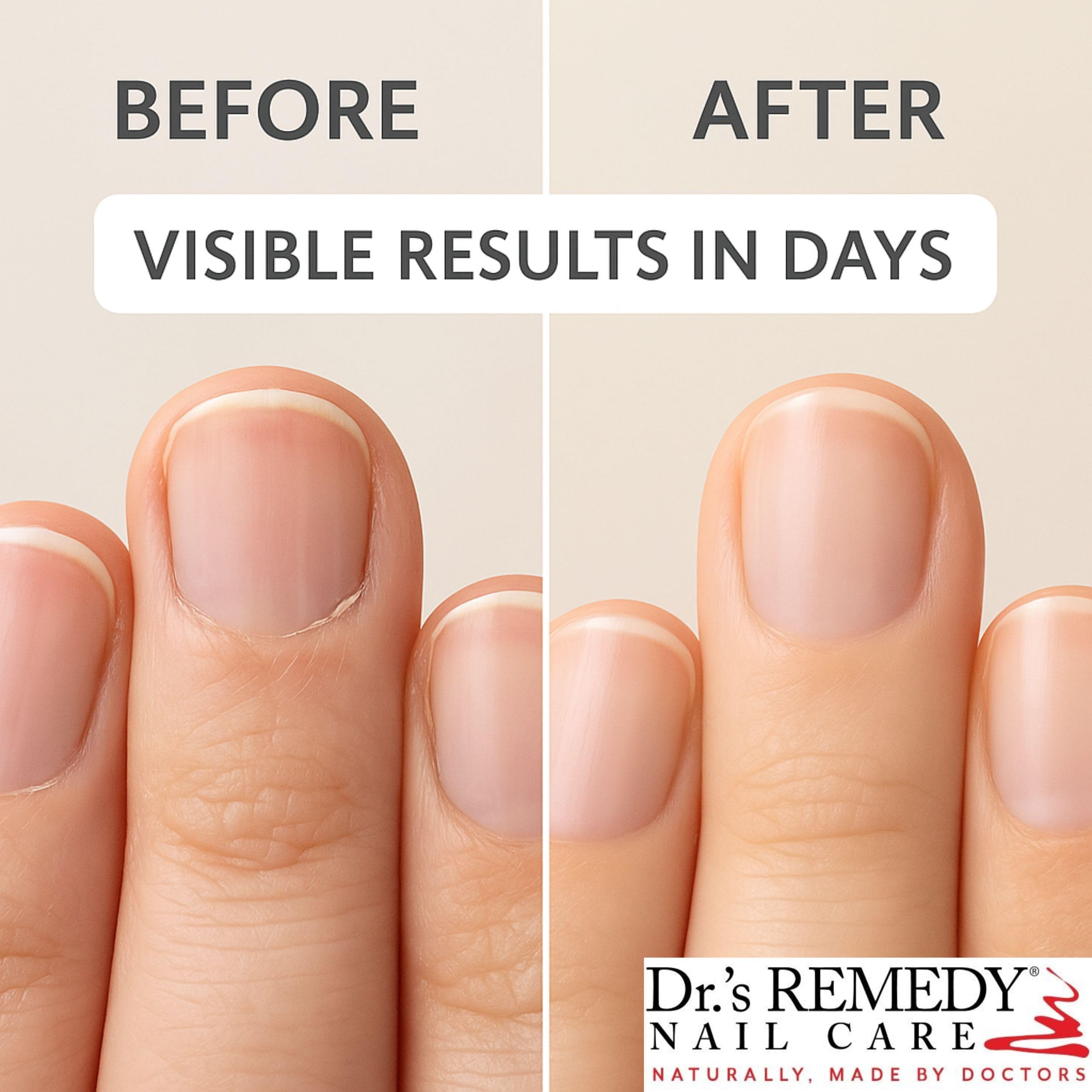 Dr.'s Remedy Caress cuticle oil ingredients and label details