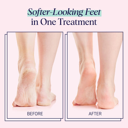 SpaLife dermatologist recommended nail mask back packaging