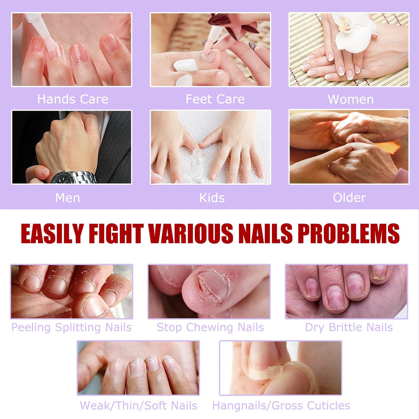 Travel friendly packaging of Grunil nail growth treatment set