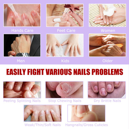Travel friendly packaging of Grunil nail growth treatment set