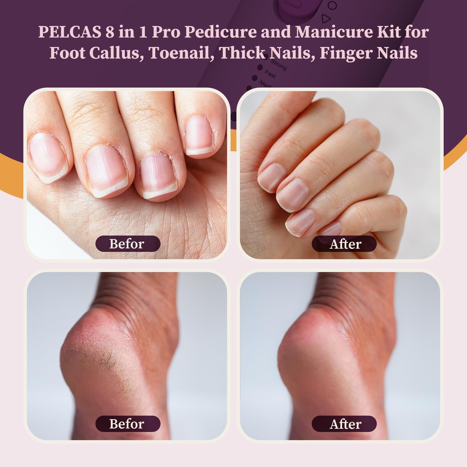 Pelcas electric nail drill with LED light and attachments