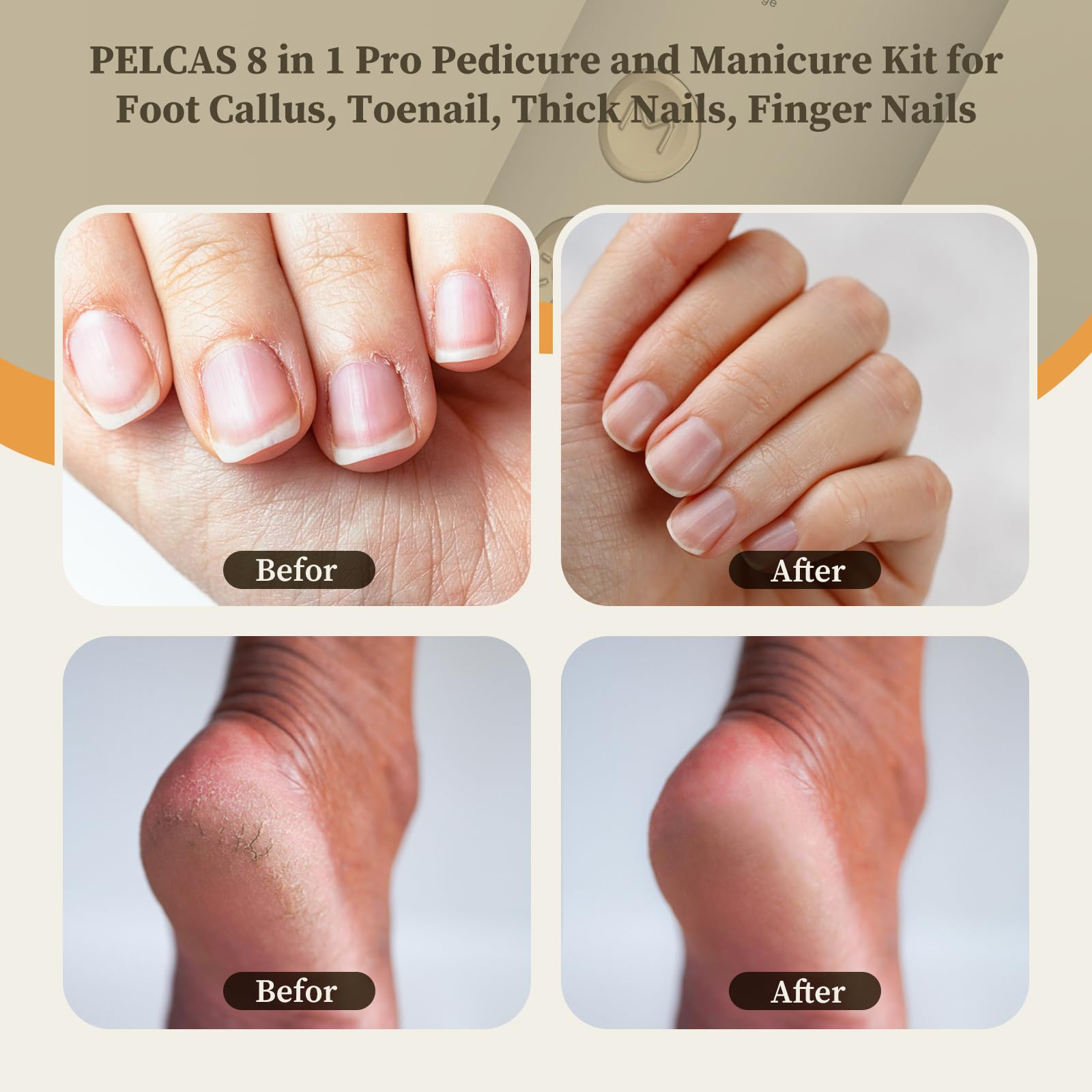 Pelcas electric nail file kit with drill bits and accessories