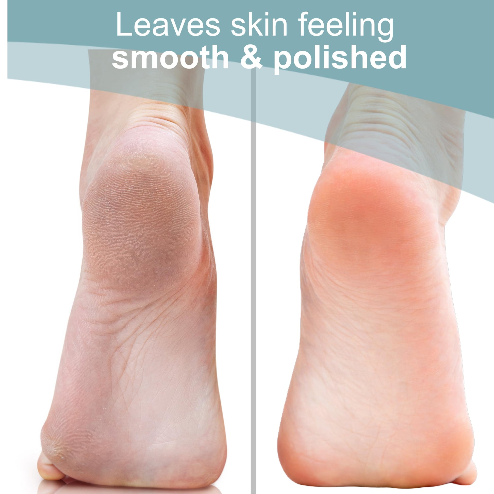 Trim Neat Feet stone in packaging