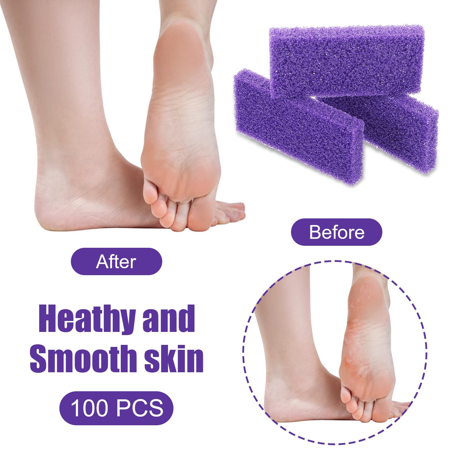 100 piece bulk set of disposable foot callus removers