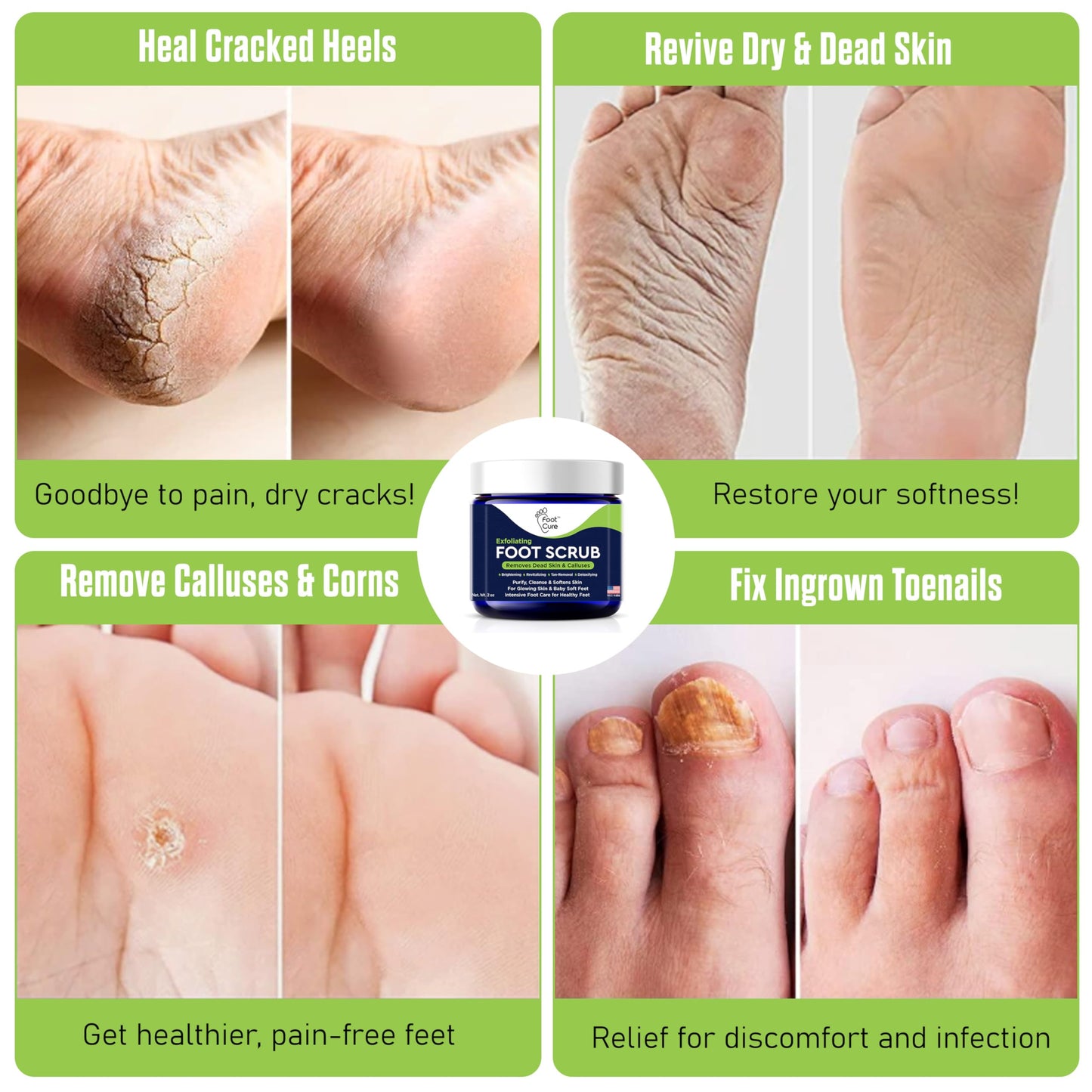 Foot Cure exfoliating foot scrub 2 fluid ounces jar
