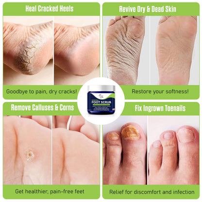 Foot Cure exfoliating foot scrub 2 fluid ounces jar