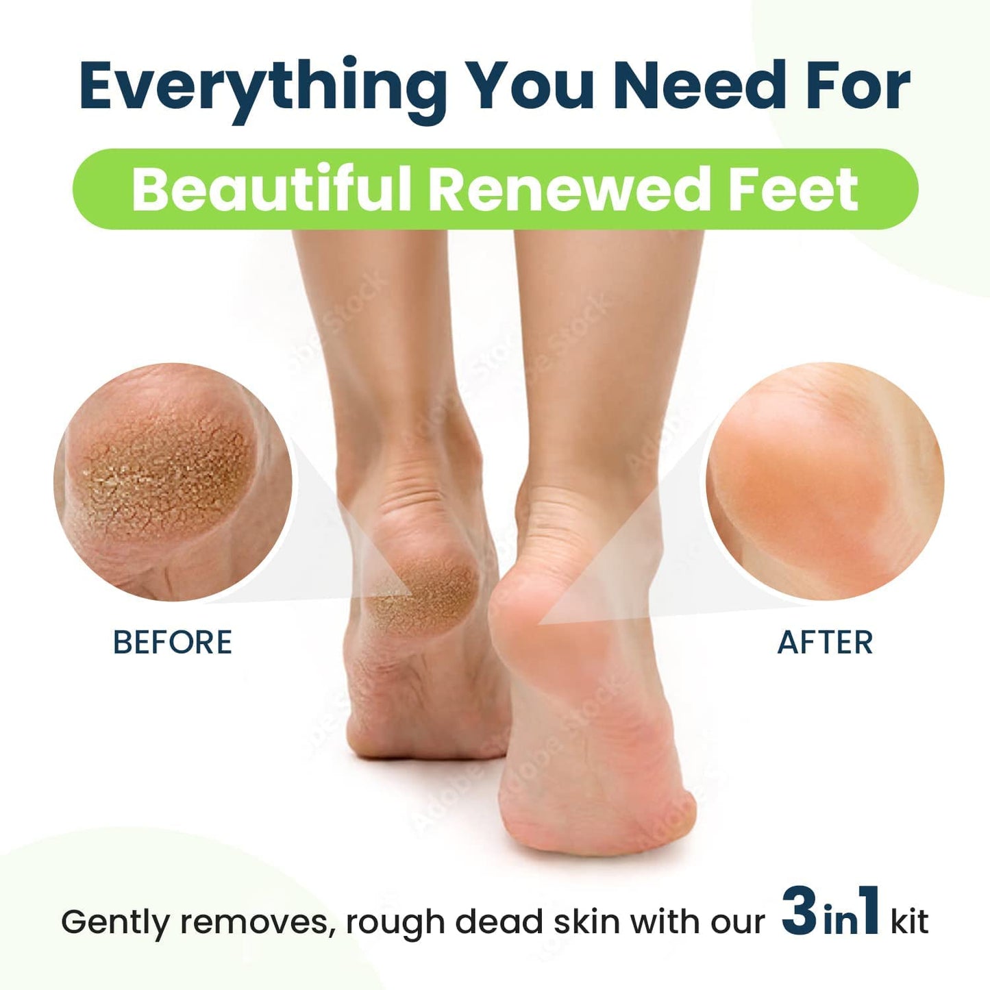 Detailed view of Foot Cure extra strength gel and pedicure tools