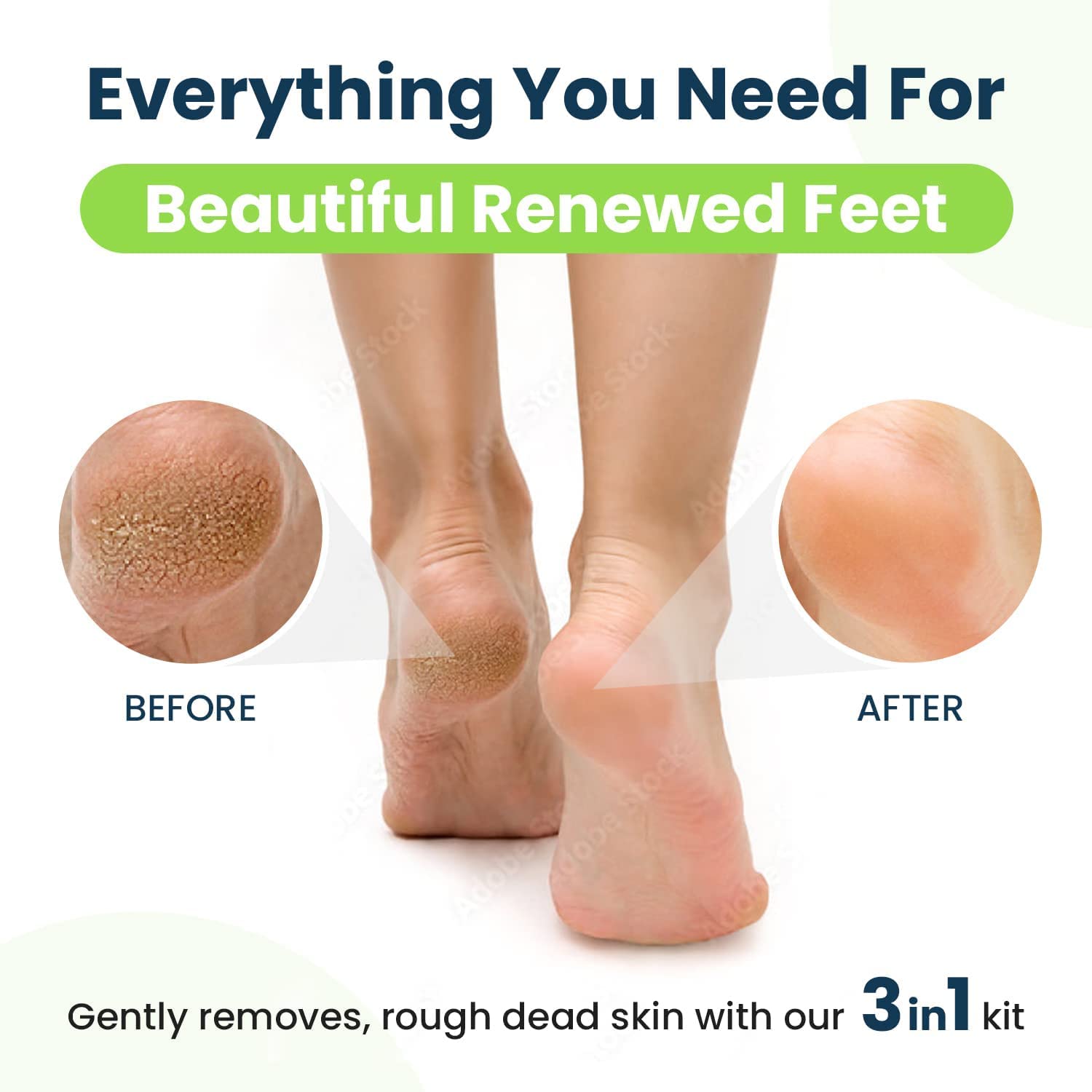 Detailed view of Foot Cure extra strength gel and pedicure tools