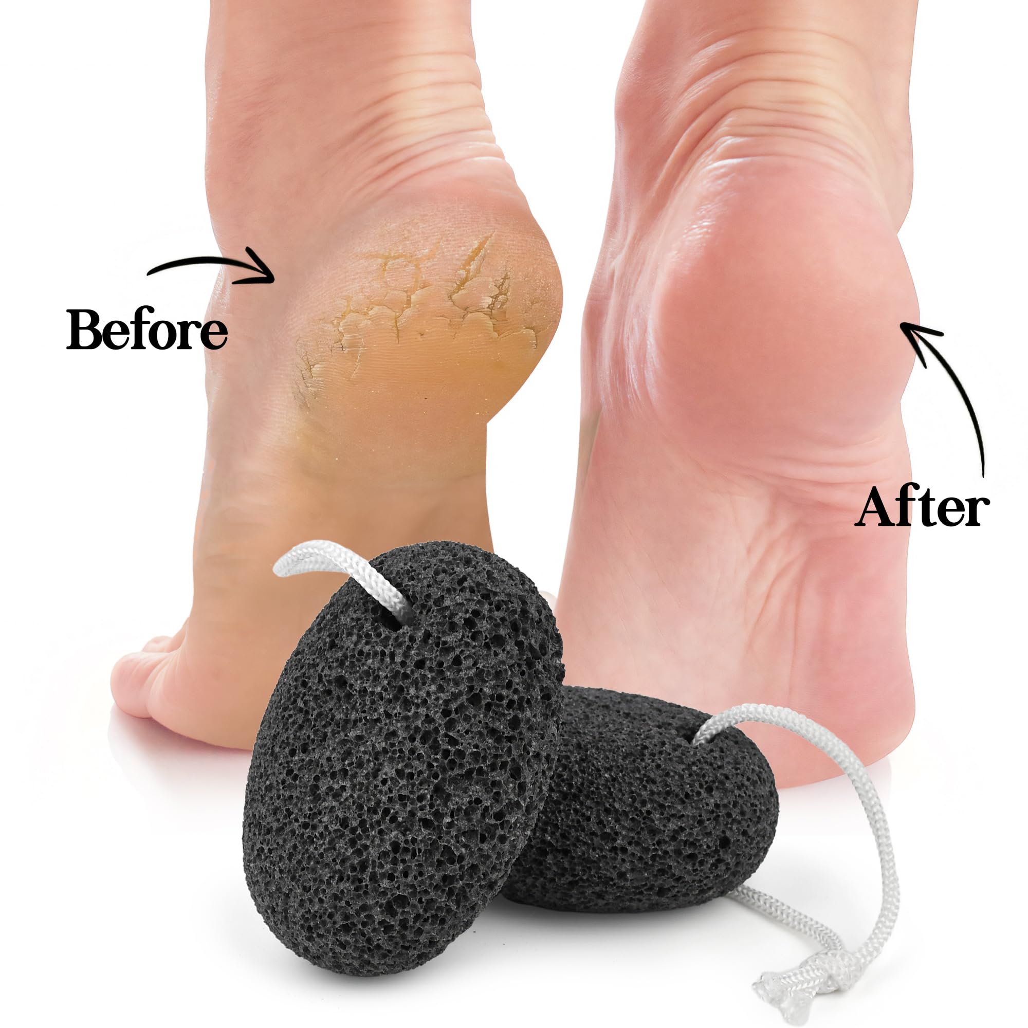 Top view of two Salvmary lava stones with suction cup accessories