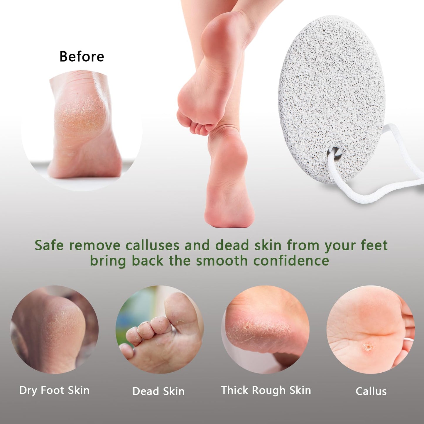 Hand holding ergonomic Borogo pumice stone for callus removal