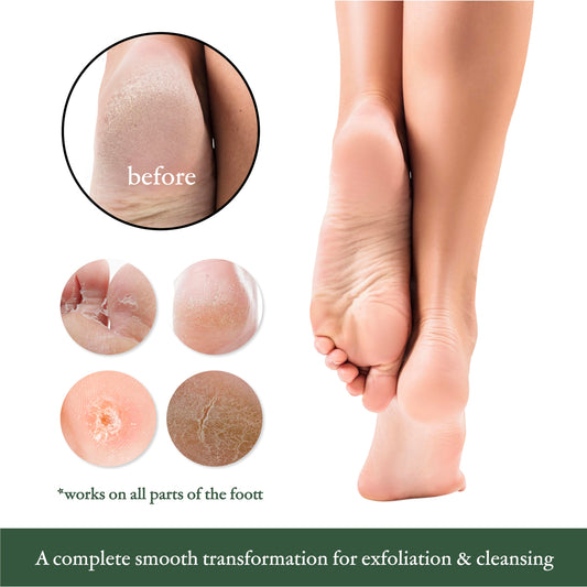 Close up of black pumice stone texture for callus removal