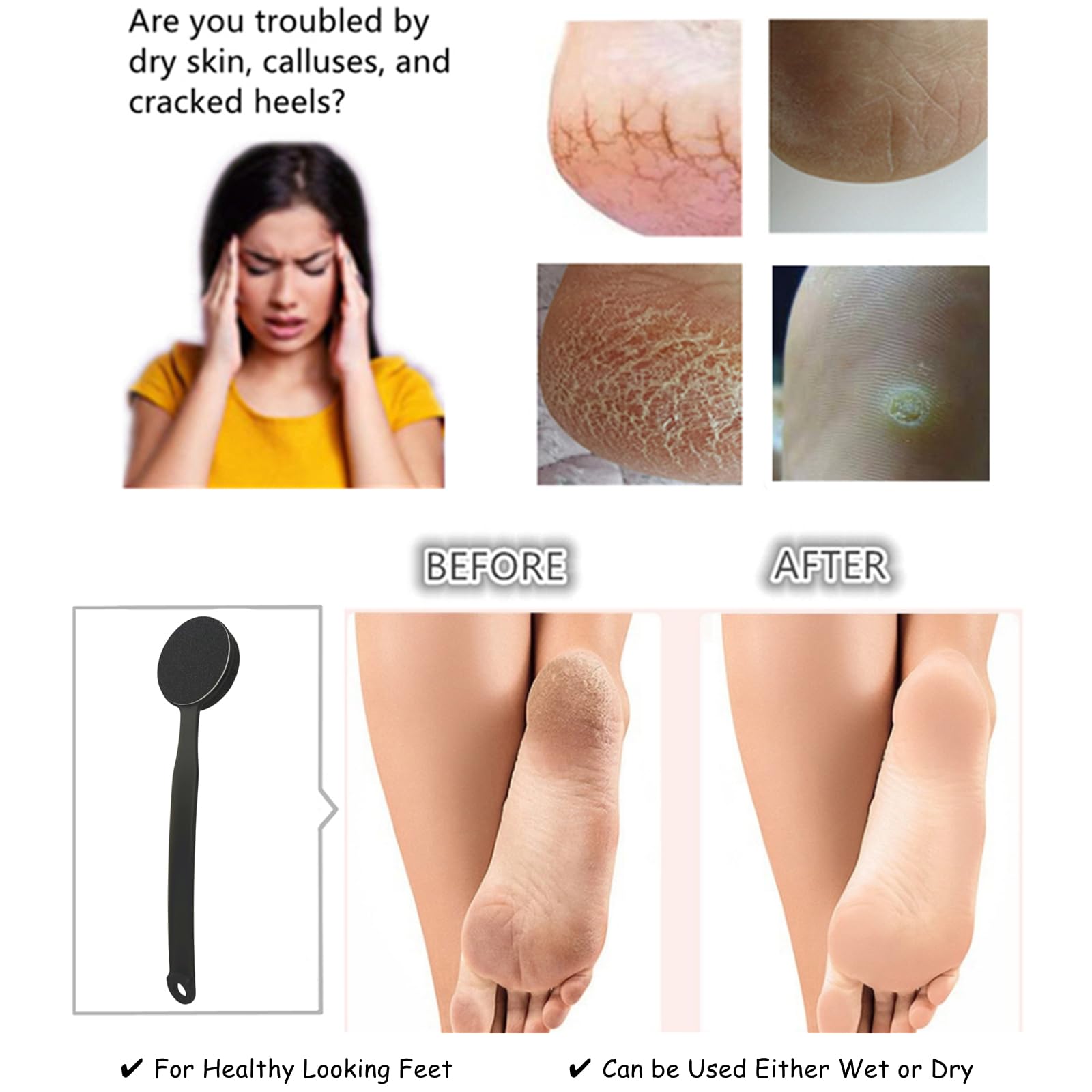 Person using Beomeen callus remover on heel in shower