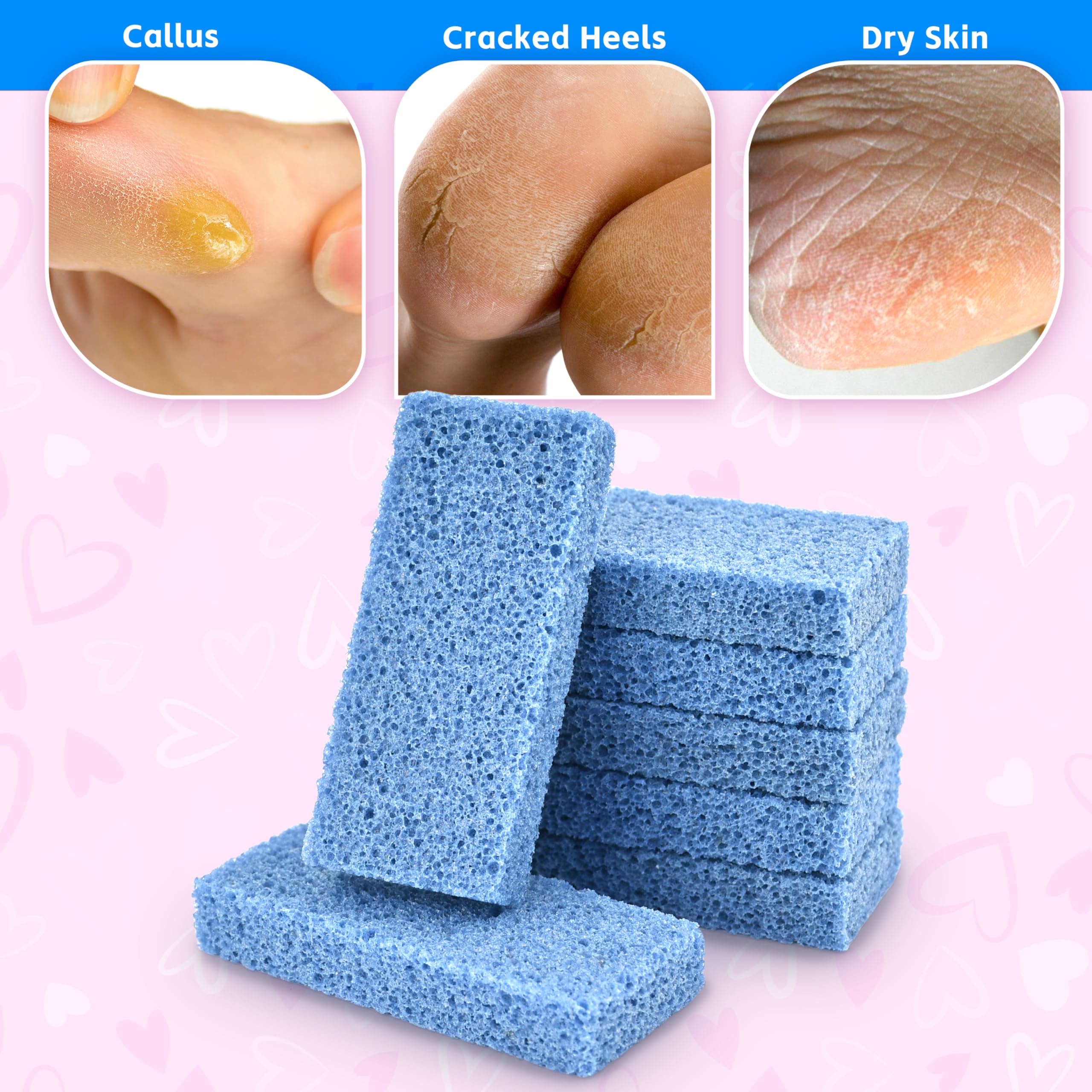 Using Salvmary pumice stone on heel for callus removal