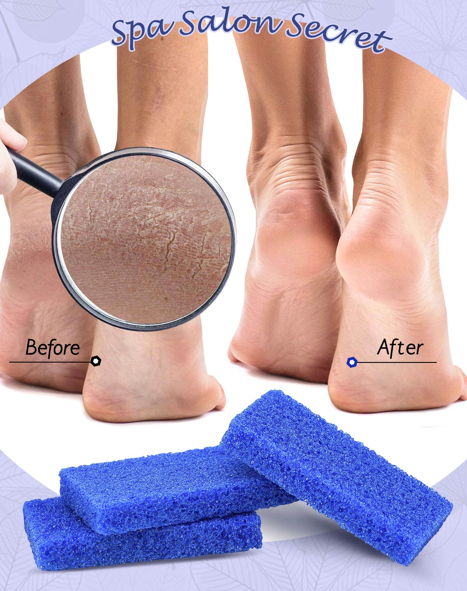 Using a blue pumice pad for foot callus removal