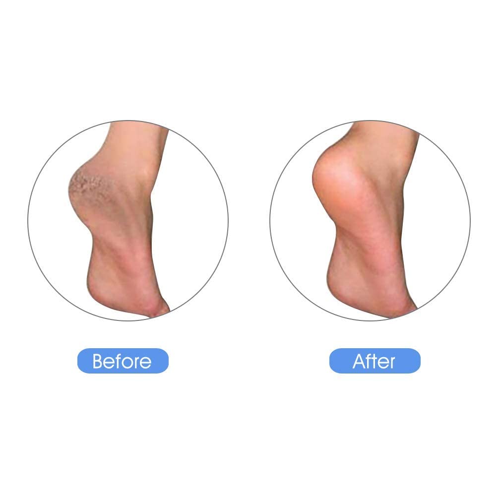 KuuCare pumice stone held for heel scrubbing