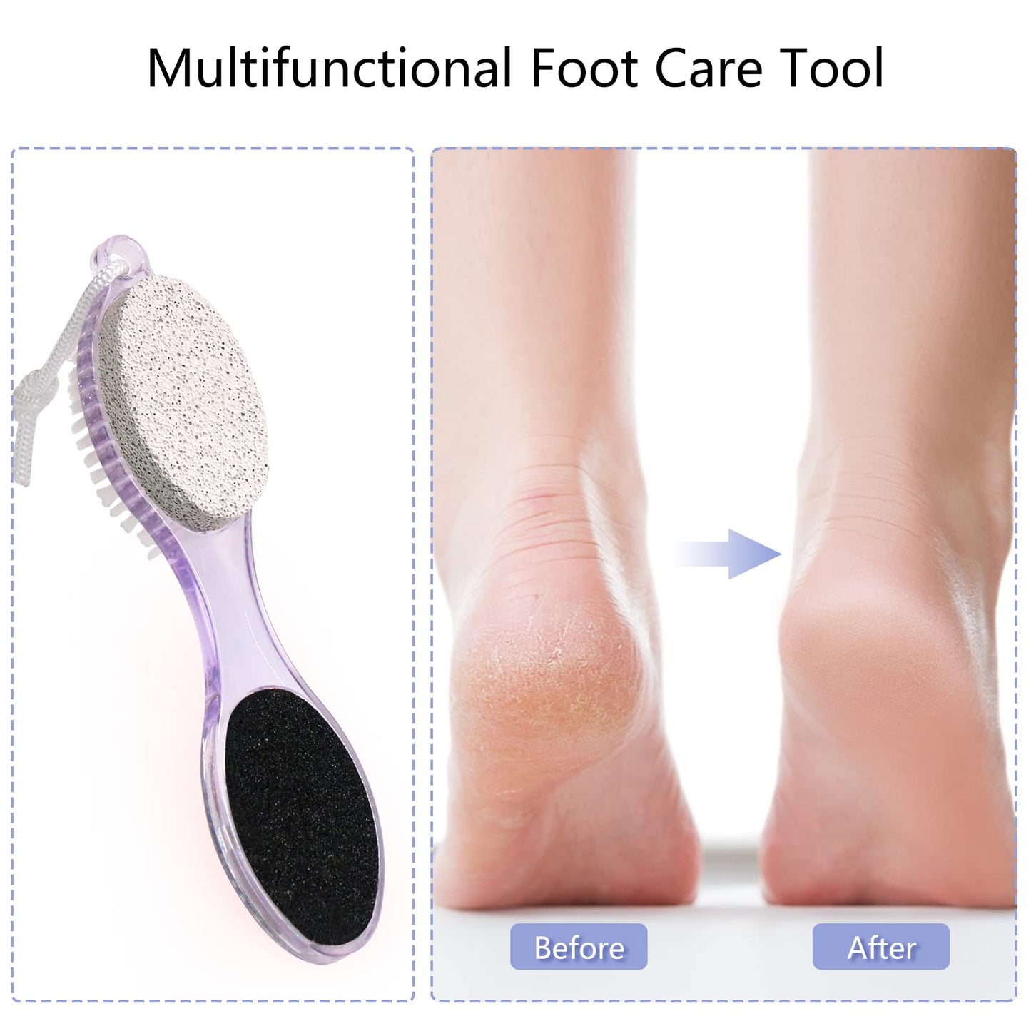Fangze foot scrubber kit in packaging for retail