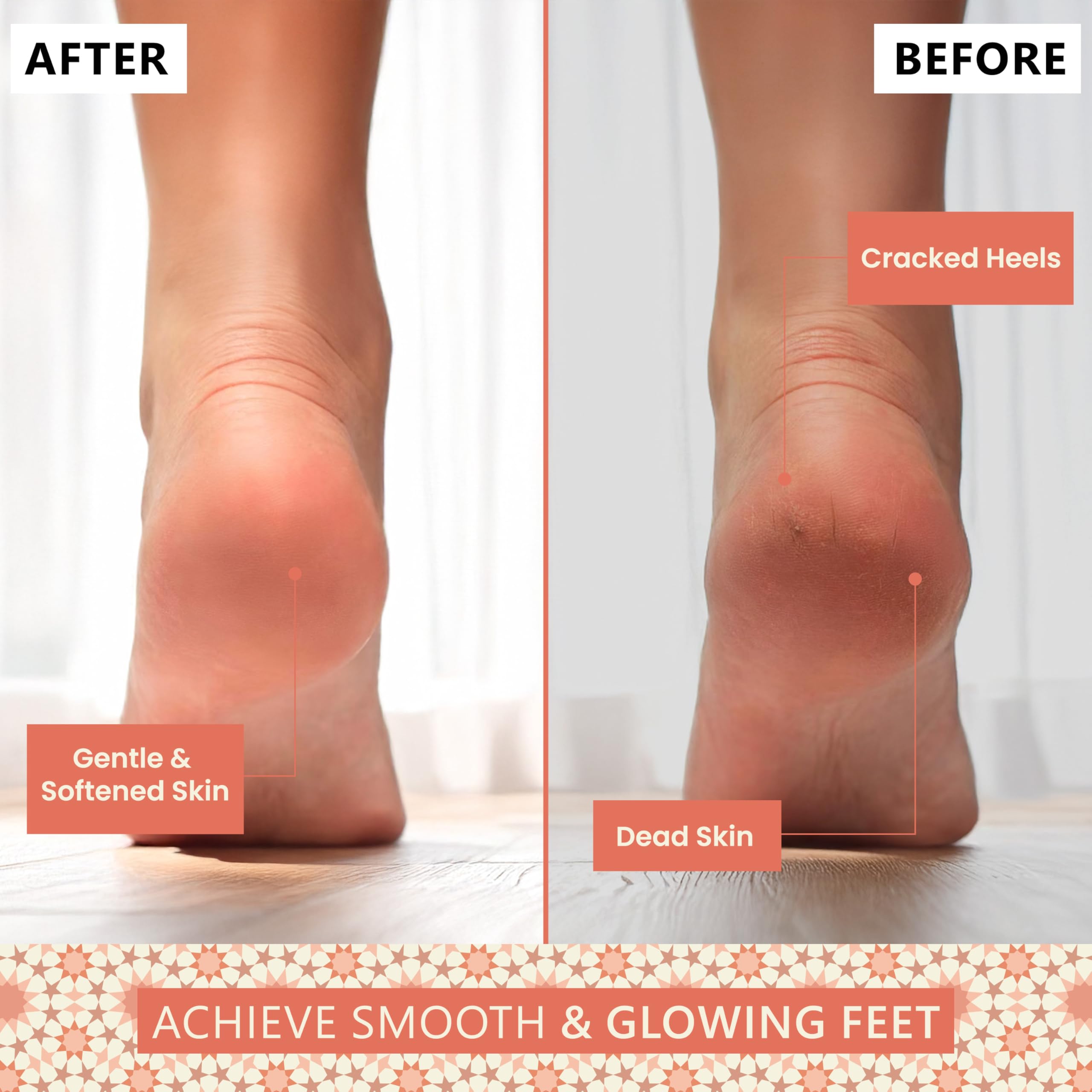 Side profile of Argaviva natural callus remover stone