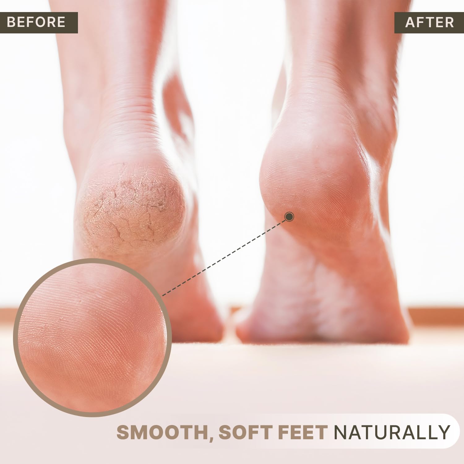 Authentic USA imported beauty tool close up highlighting the porous exfoliating surface for cracked heels.