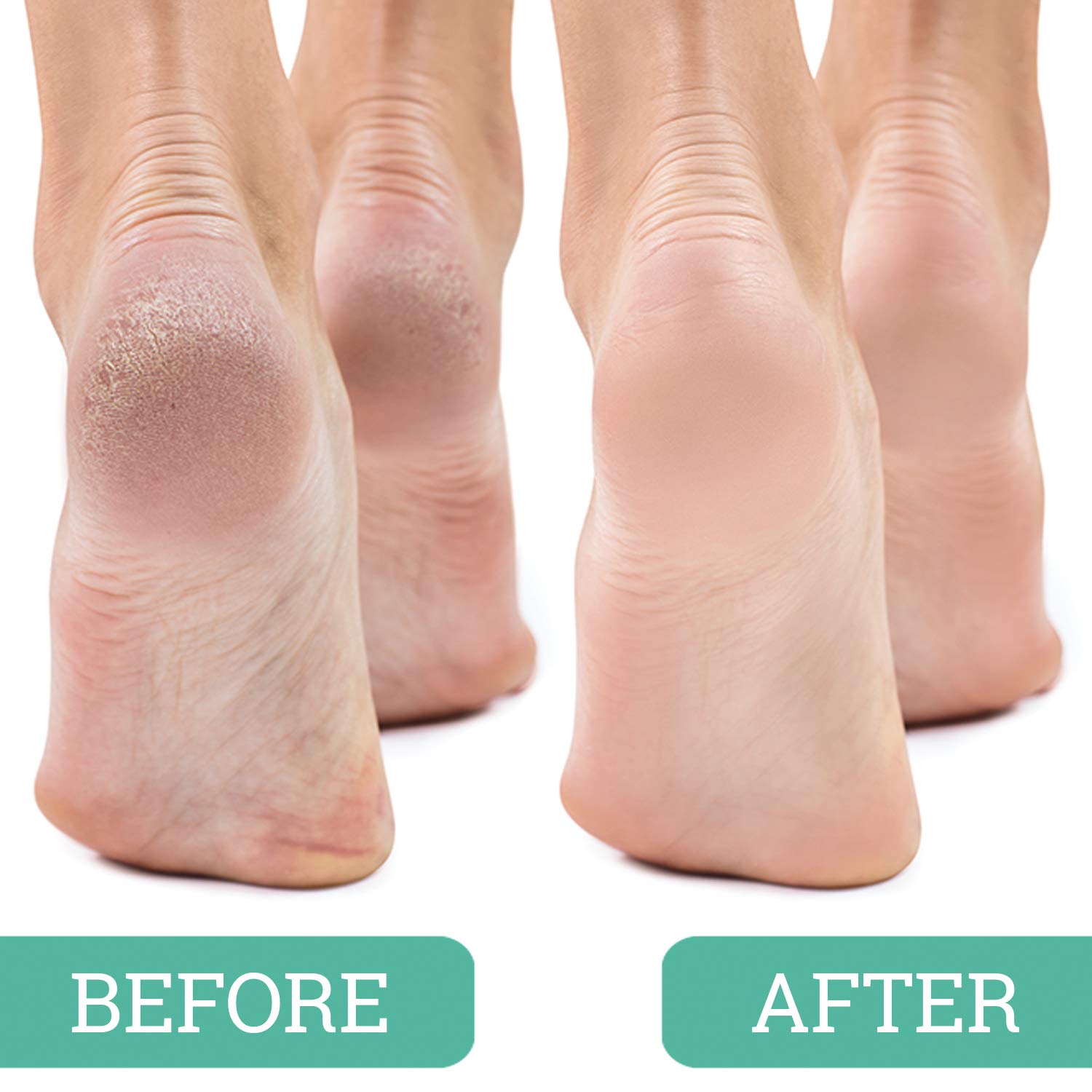 Pack of four Maccibelle pedicure stones individually wrapped