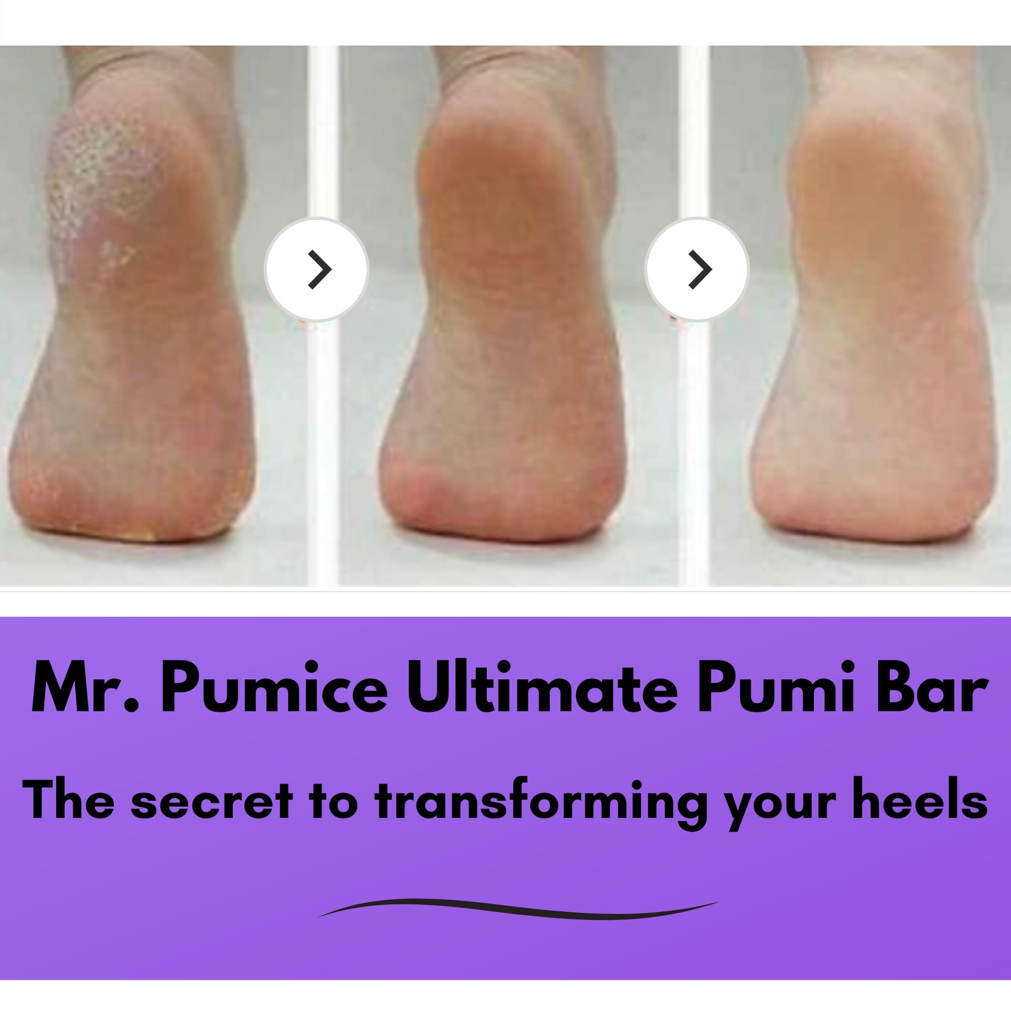 Using Mr. Pumice pedicure stone on heels for smooth skin
