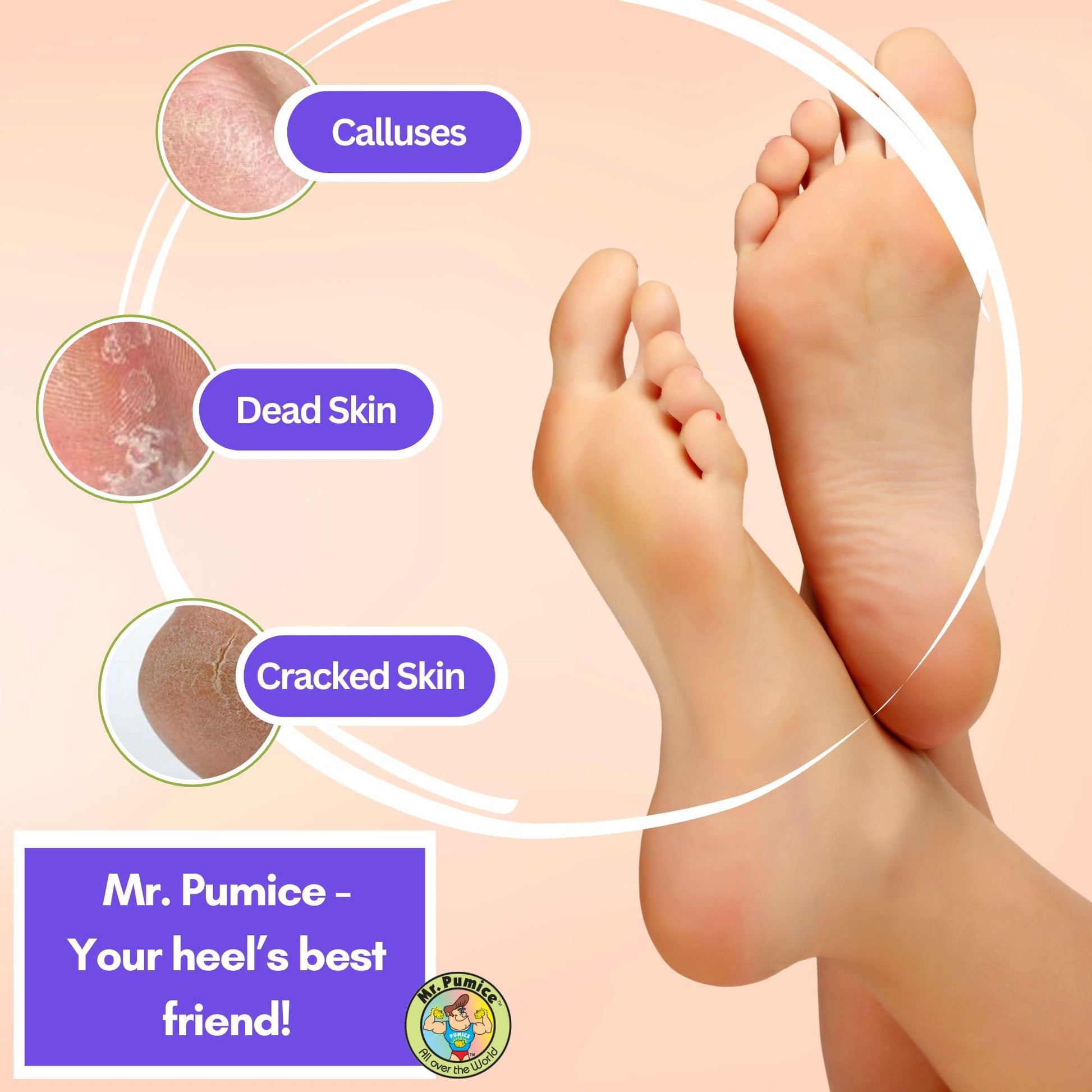 Top view of Mr. Pumice synthetic polyurethane pedicure scrubber