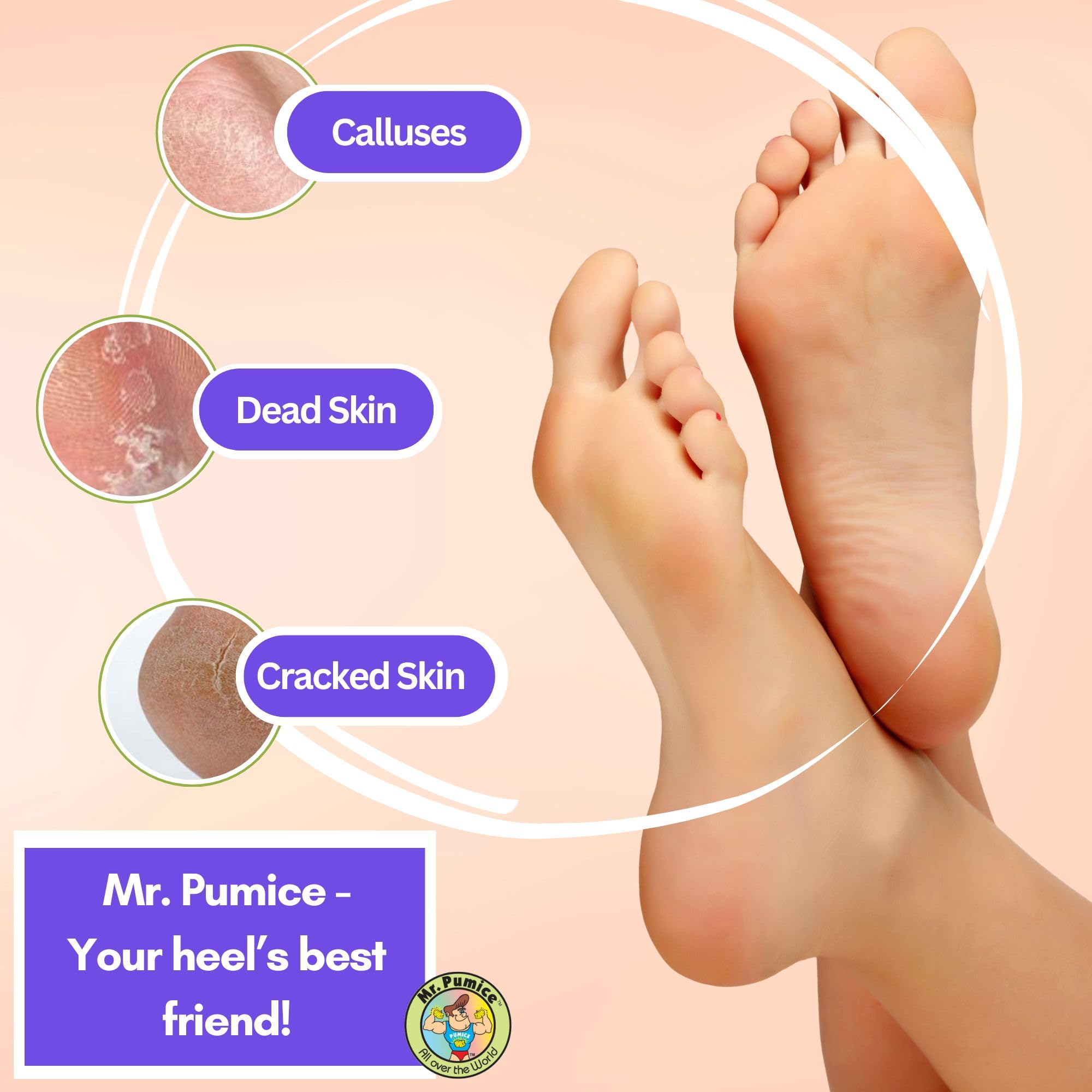 Top view of Mr. Pumice synthetic polyurethane pedicure scrubber