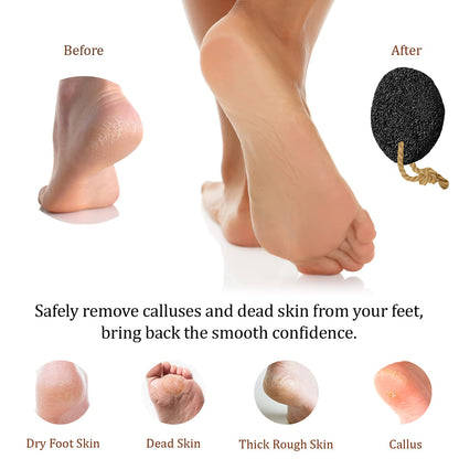 Using volcanic lava stone to exfoliate dry foot skin