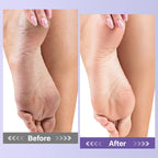 Instructions for using Mosrrou foot spa kit for cracked heels