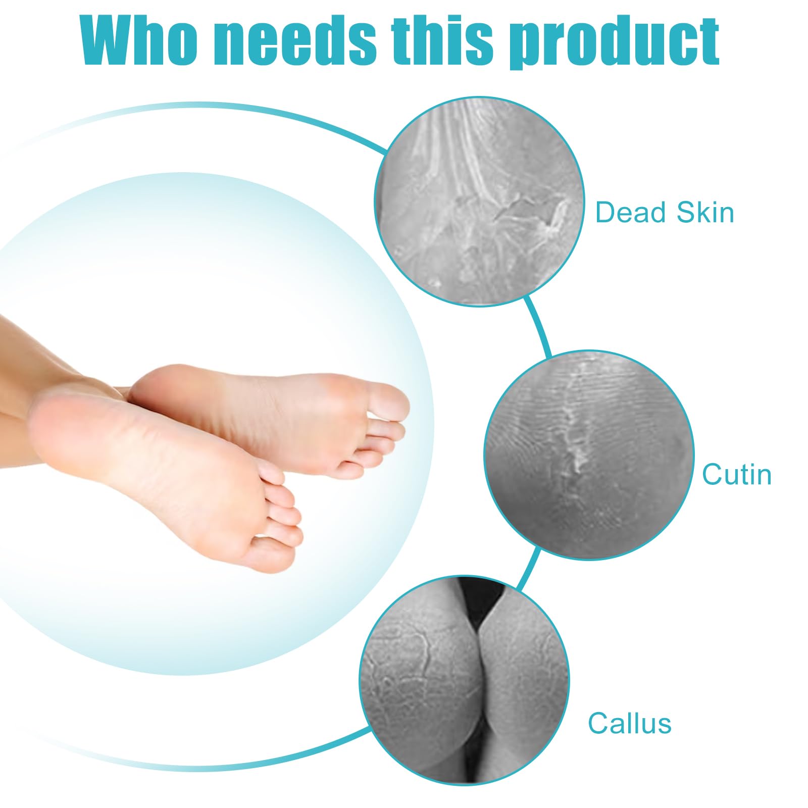 Yclin 4 in 1 foot file in use for smooth heel treatment